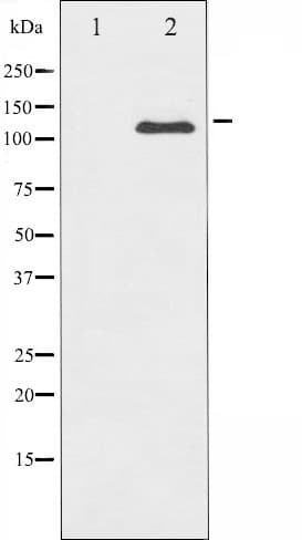 Polyclonal Rabbit anti-Human c-Kit / CD117 Antibody (IHC, IF, WB)