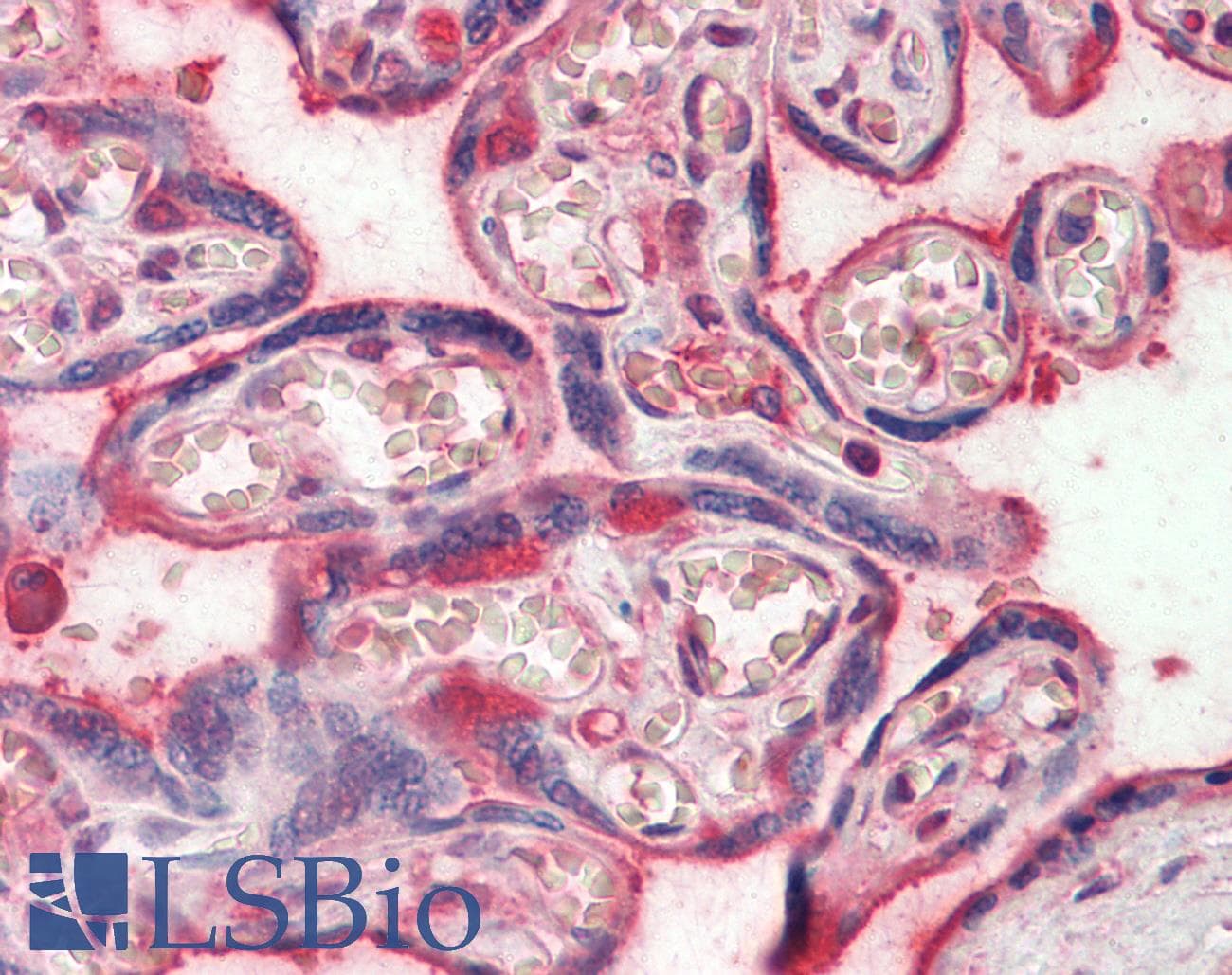 IHC-plus™ Polyclonal Goat anti-Human Complement C6 Antibody (IHC, WB)