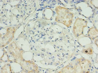 RPUSD4 Antibody