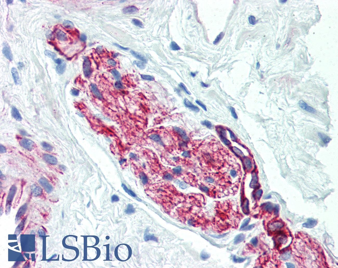 IHC-plus™ Monoclonal Mouse anti-Human NES / Nestin Antibody (clone 2C1.3A11, IHC, WB)