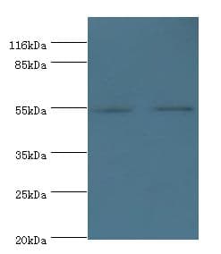 THRA / THR Alpha Antibody (aa1-490, HRP)
