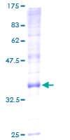 Human ATP5G2 Protein (Recombinant GST)