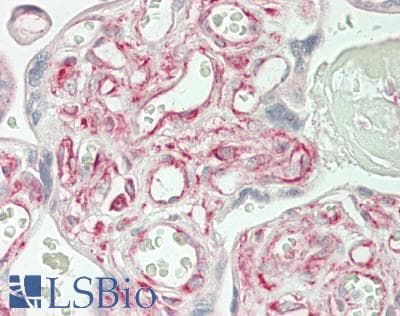 IHC-plus™ Polyclonal Rabbit anti-Human ABCB10 Antibody (Internal, IHC, IF, WB)