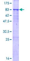 Human TRIM65 Protein (Recombinant GST)