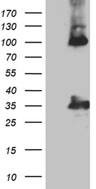 CALB2 / Calretinin Antibody (clone OTI1A1)