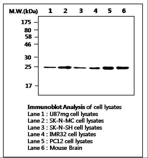 IHC-plus™ UCHL3 Antibody