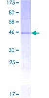 Human NOG / Noggin Protein (Recombinant GST)