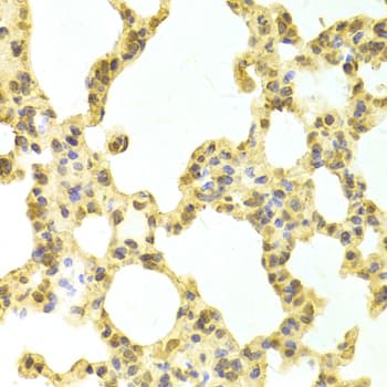 Polyclonal Rabbit anti-Human DNAJB1 / Hsp40 Antibody (IHC, IF, WB)