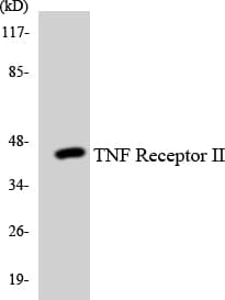 TNFRSF1B / TNFR2 Antibody (aa363-412)