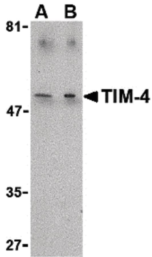 IHC-plus™ Polyclonal Rabbit anti-Human TIMD4 / TIM4 / TIM-4 Antibody (IHC, WB)