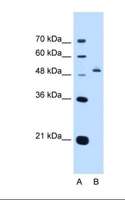 Polyclonal Rabbit anti-Human PAX8 Antibody (aa151-200, IHC, WB)