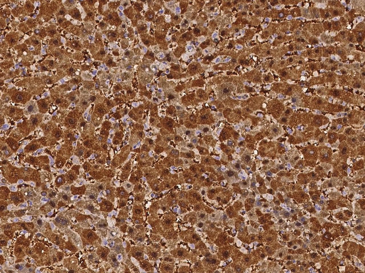 Polyclonal Rabbit anti-Human ARG1 / Arginase 1 Antibody (IHC)