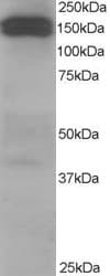 IHC-plus™ Polyclonal Goat anti-Human DCTN1 / Dynactin 1 Antibody (aa1266-1278, IHC, IF, WB)