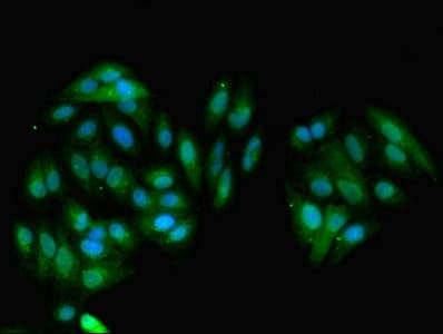 GNMT Antibody