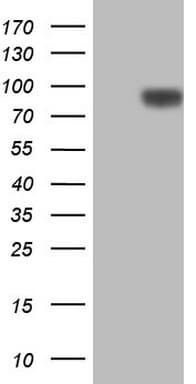 CFI / Complement Factor I Antibody (aa340-583, clone OTI4E9)