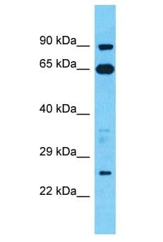 Polyclonal Rabbit anti-Human TESC Antibody (aa53-102, WB)