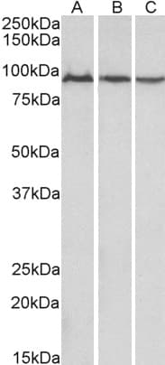 IHC-plus™ Polyclonal Goat anti-Human ACO2 / Aconitase 2 Antibody (aa541-555, IHC, WB)
