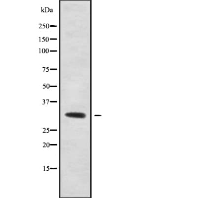 ACER1 / ASAH3 Antibody