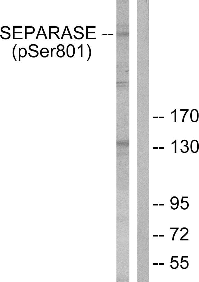 EIF4EBP1 / 4EBP1 Antibody (phospho-Thr69)
