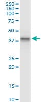 ABO Glycosyltransferase Antibody (clone 1B7)