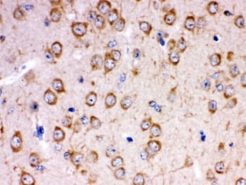 Polyclonal Rabbit anti-Human KCNIP2 / KCHIP2 Antibody (IHC, WB)