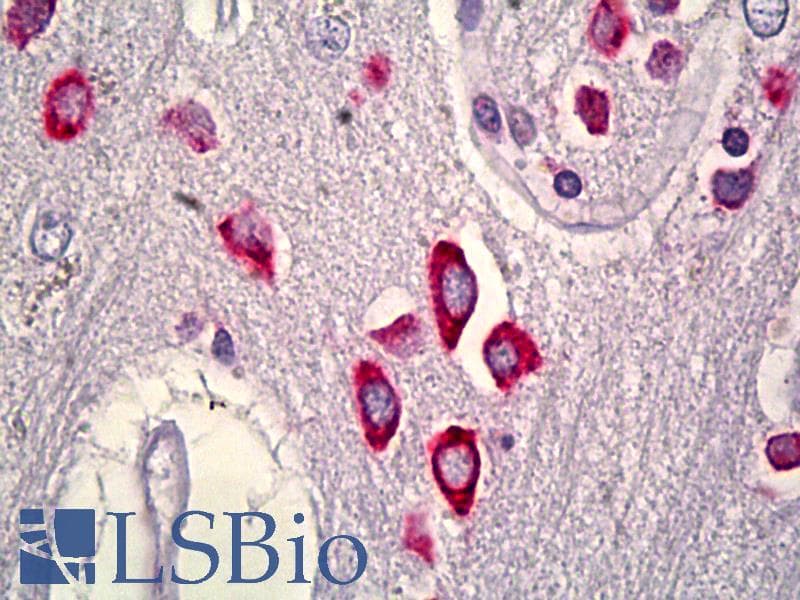 IHC-plus™ RIT2 / RIN Antibody (clone 27G2)