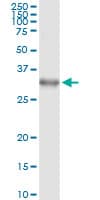 DLX1 Antibody (clone 2H3)