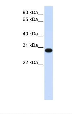 PSF1 / GINS2 Antibody (N-Terminus, HRP)