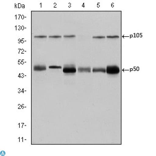 Monoclonal Mouse anti-Human NFKB1 / NF-Kappa-B Antibody (IHC, WB)