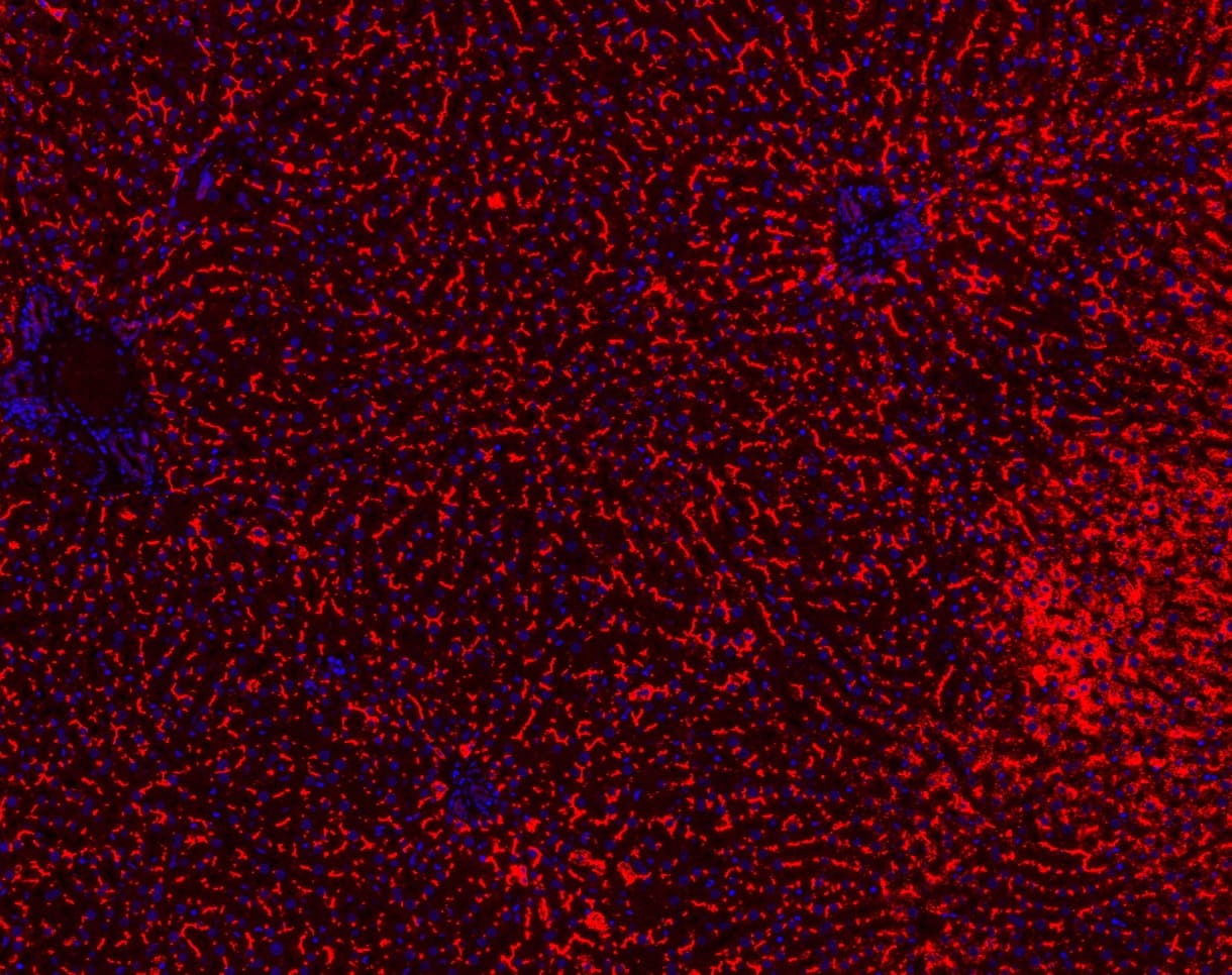 ABCB11 / BSEP Antibody