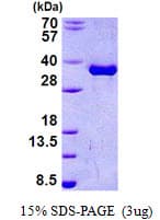 Human TOR1A / Torsin A Protein (Recombinant His)