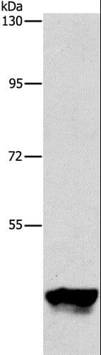 Polyclonal Rabbit anti-Human PIP4K2A / PIPK Antibody (IHC, WB)