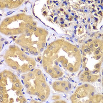 LZTR1 Antibody