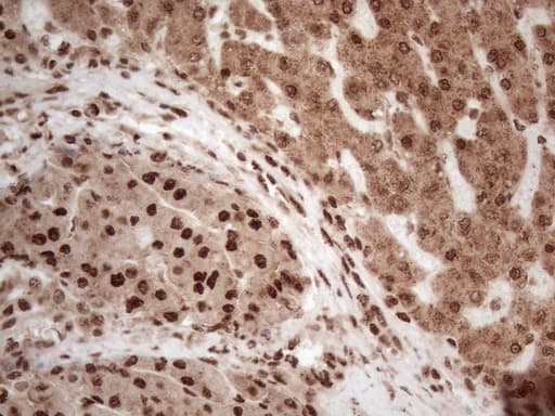 IRS1 Antibody (aa1-280, clone OTI3G10, Carrier-free)
