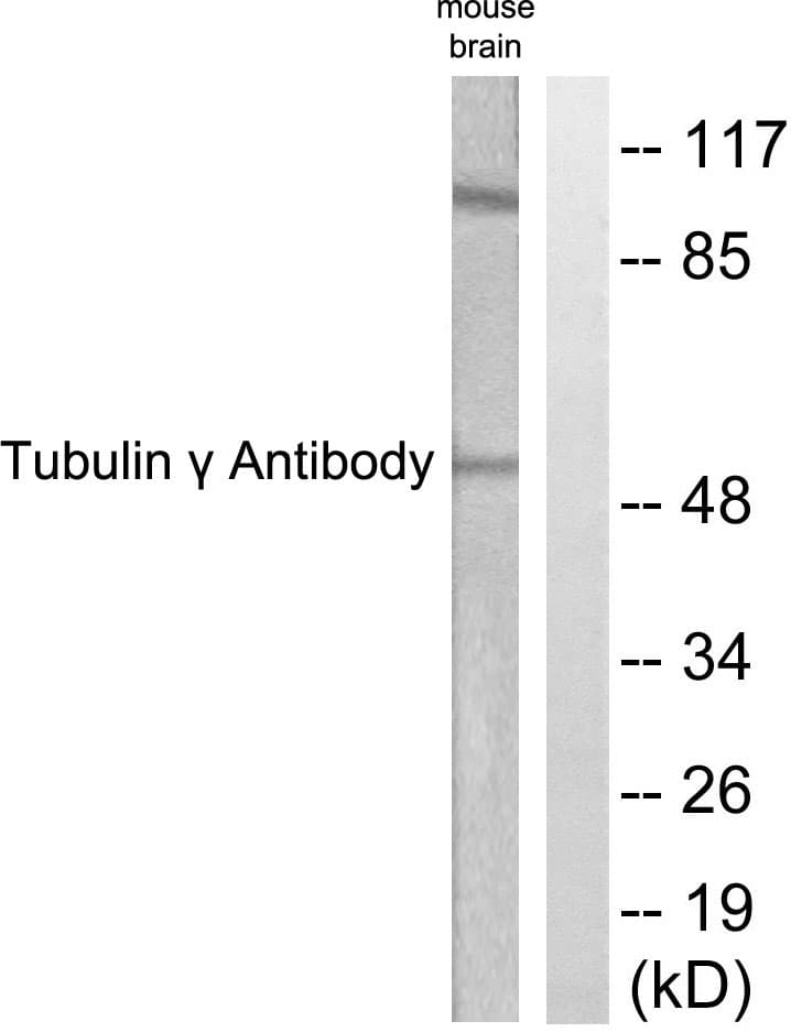 IHC-plus™ Polyclonal Rabbit anti-Human TUBG1 / Tubulin Gamma 1 Antibody (aa386-435, IHC, WB)