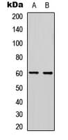 PDCD4 Antibody (C-Terminus)
