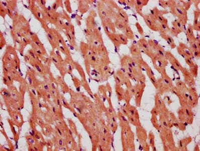 TOP1MT Antibody