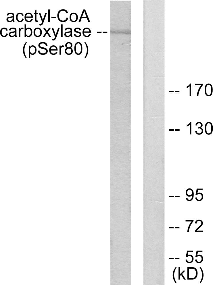 Acetyl-CoA Carboxylase / ACC Antibody (phospho-Ser80)
