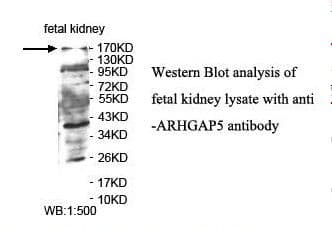 ARHGAP5 / RhoGAP5 Antibody (aa29-210)