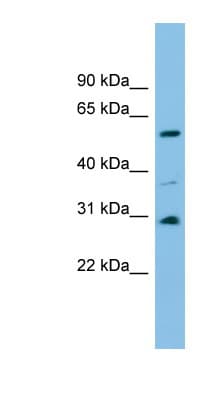 DUS1L Antibody (aa323-372)