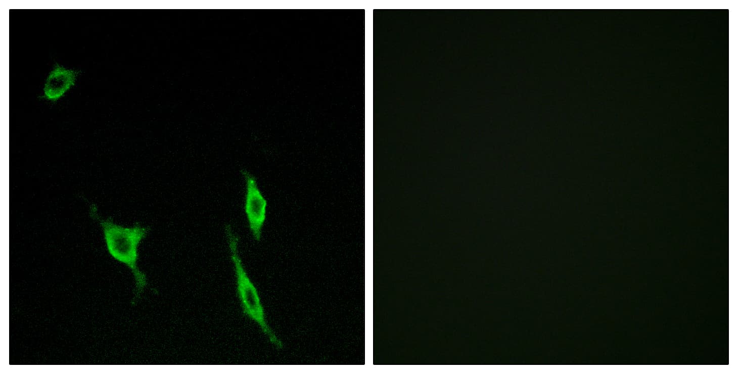 Polyclonal Rabbit anti-Human DCC Antibody (aa441-490, IF)