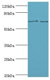 Polyclonal Rabbit anti-Human MTM1 / Myotubularin Antibody (aa484-603, IHC, WB)