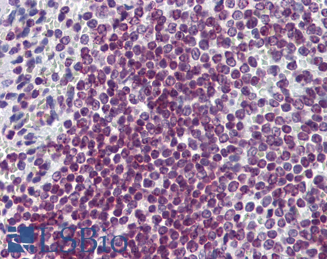 IHC-plus™ FOXO3 / FOXO3A Antibody (clone 4E8)