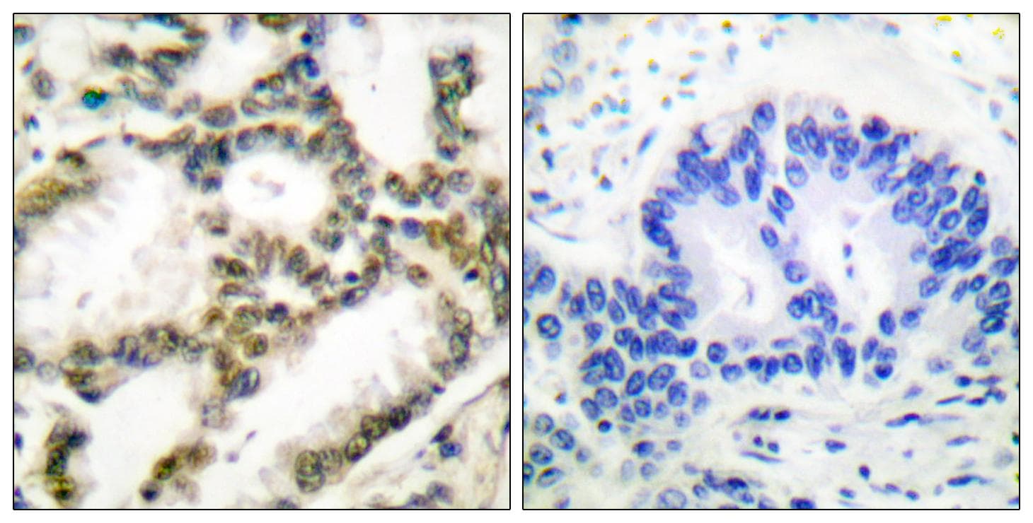 Polyclonal Rabbit anti-Human PARK7 / DJ-1 Antibody (IHC, IF, WB)