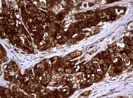 NME1 / NM23 Antibody (clone OTI1C12)