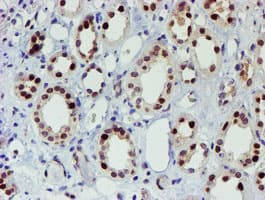 SNAI2 / SLUG Antibody (clone OTI1A6)