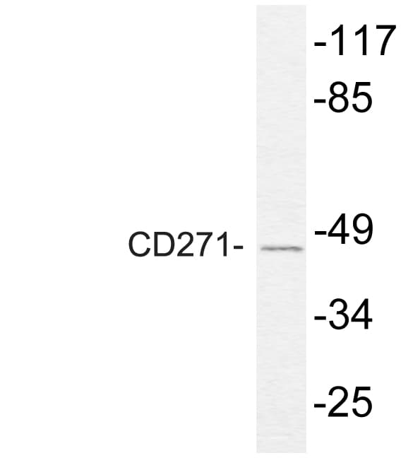 NGFR / CD271 / TNR16 Antibody (aa230-279)