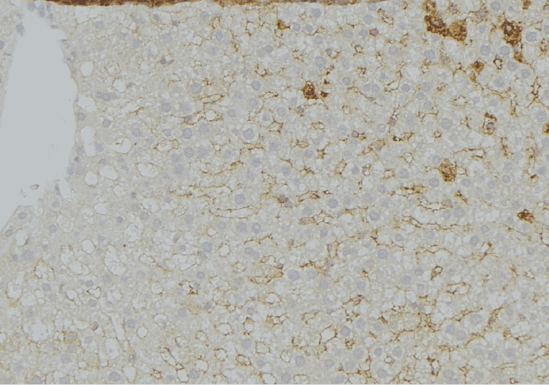 GNMT Antibody