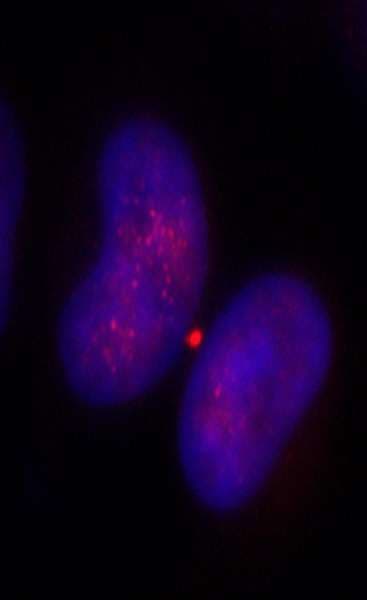 KIF14 Antibody (aa1600-C-term)