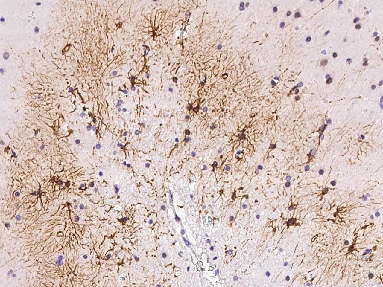 DAPK3 / ZIP Kinase Antibody (Preservative Free)